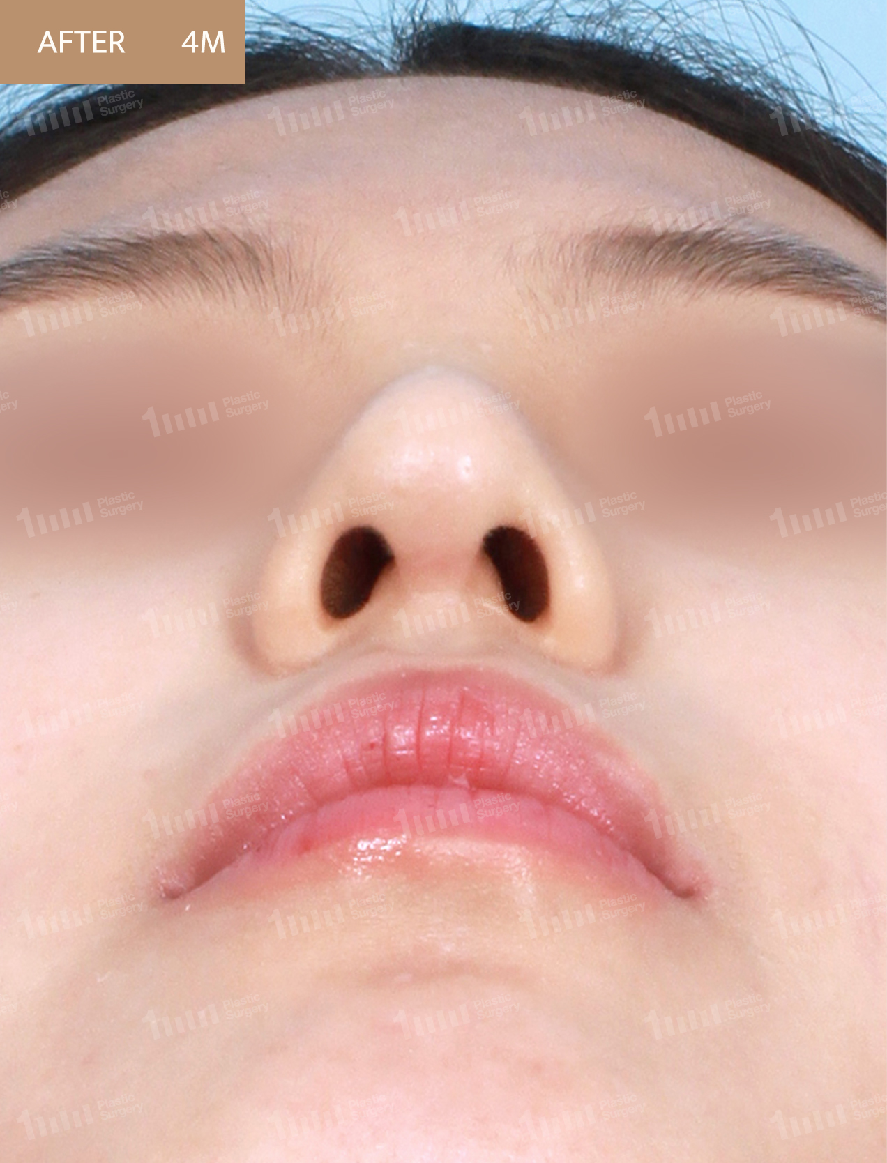 After
