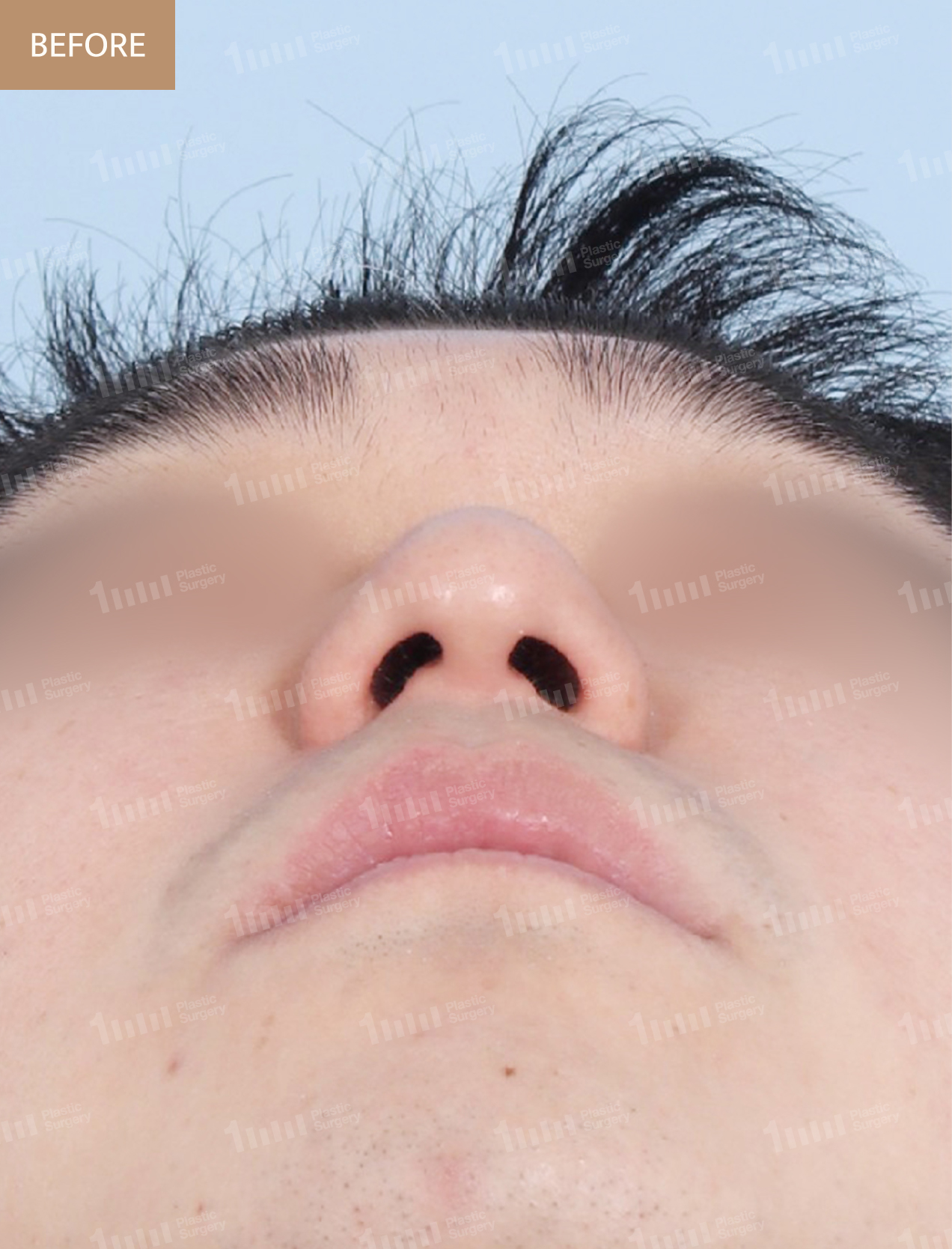 Before