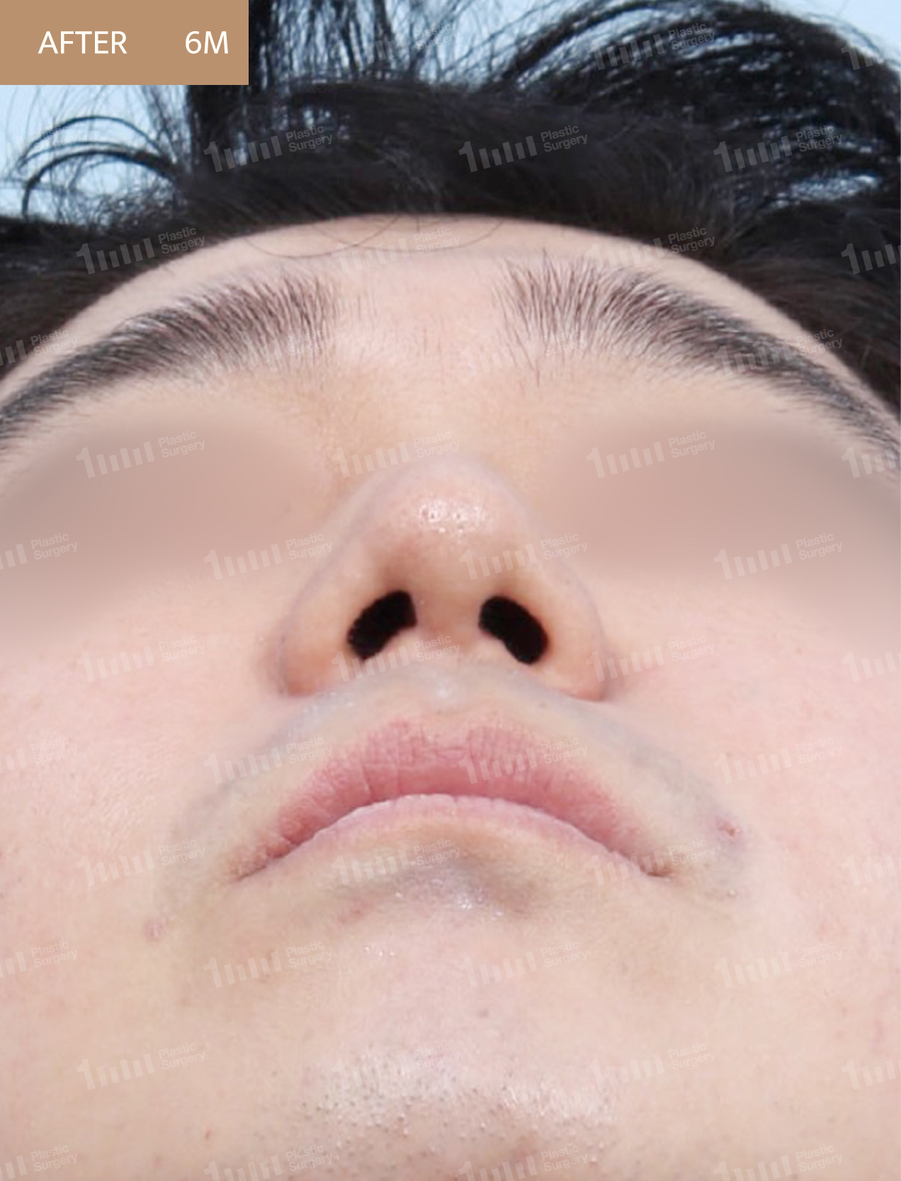 After