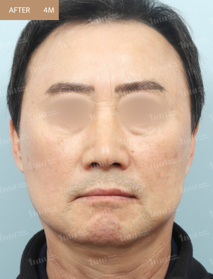 After