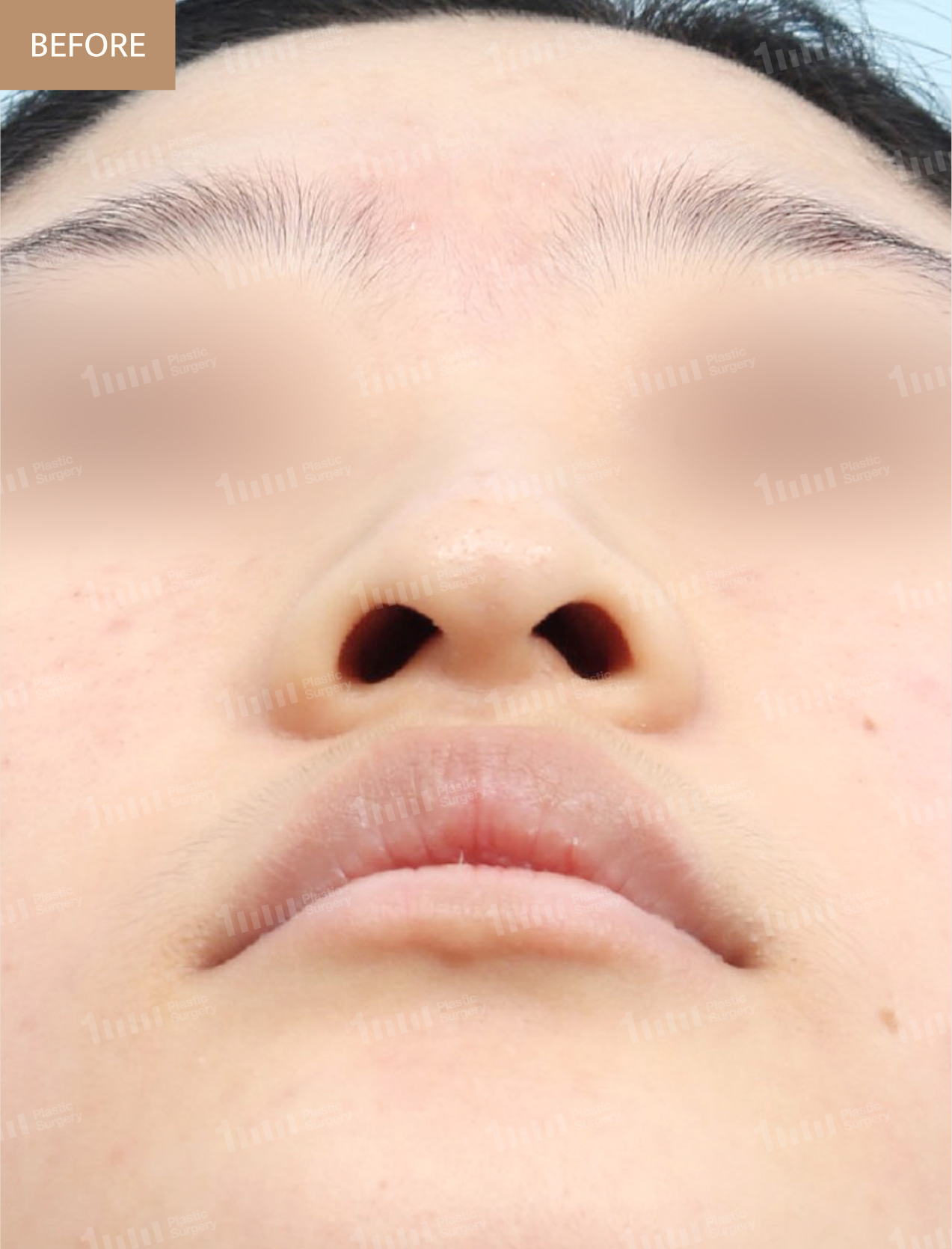Before