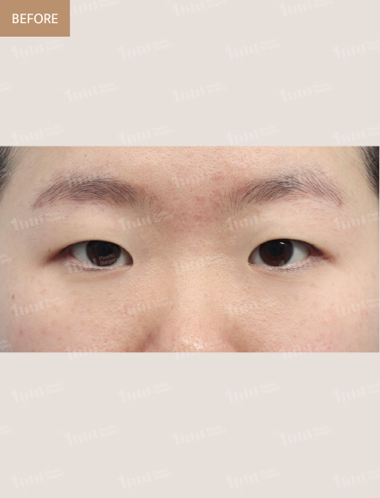 Before