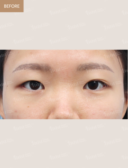 Before