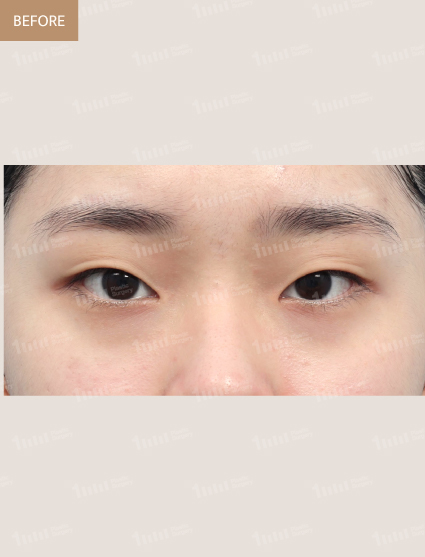 Before