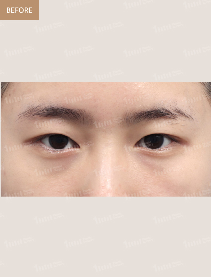Before