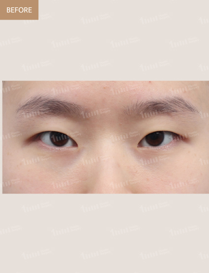 Before
