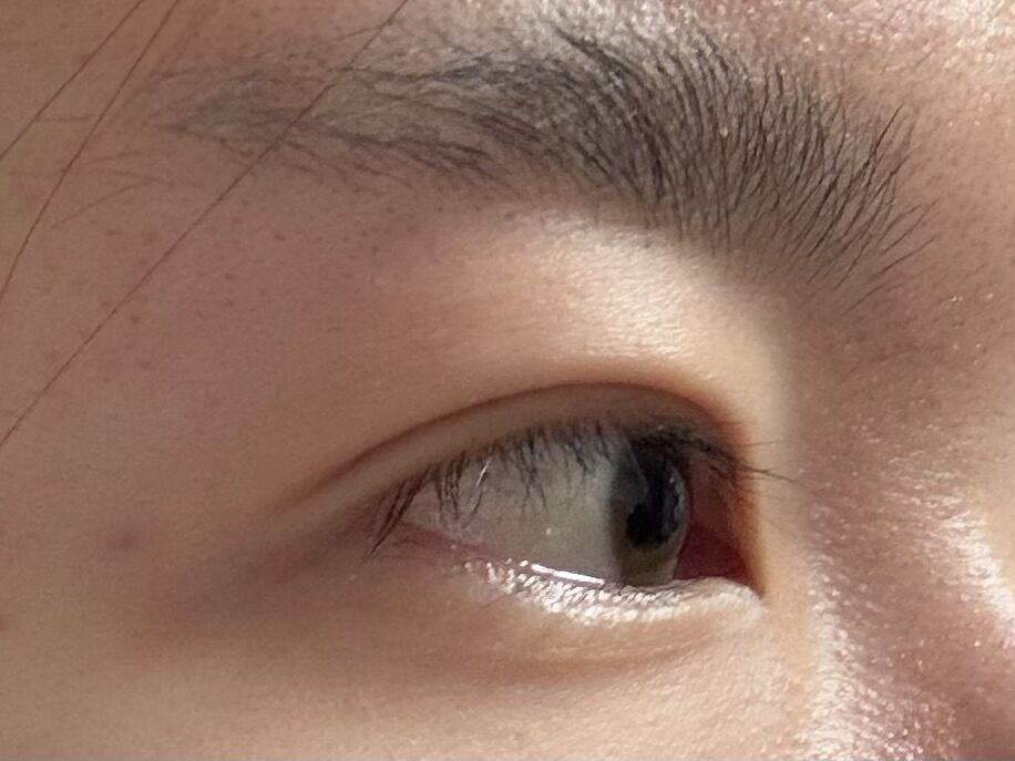 오른쪽 측면