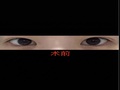 都彦禄院长 - 全切双眼皮