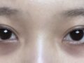 雙眼+眼下區域回顧