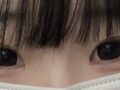 Ilmiri非切開雙眼皮手術 開內眼角手術